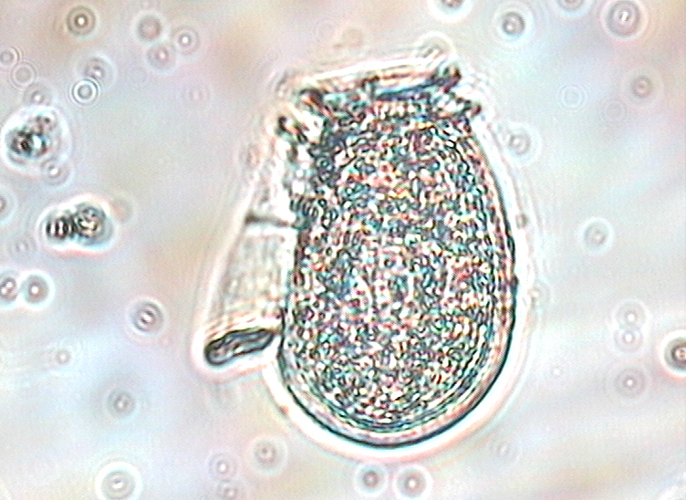 Dictyocha speculum